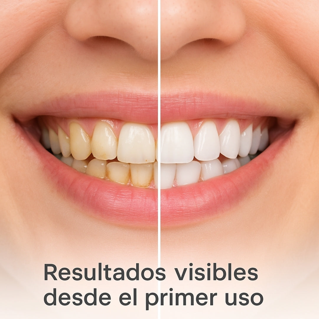 HydroX -  Irrigador Bucodental | OFERTA 2X1